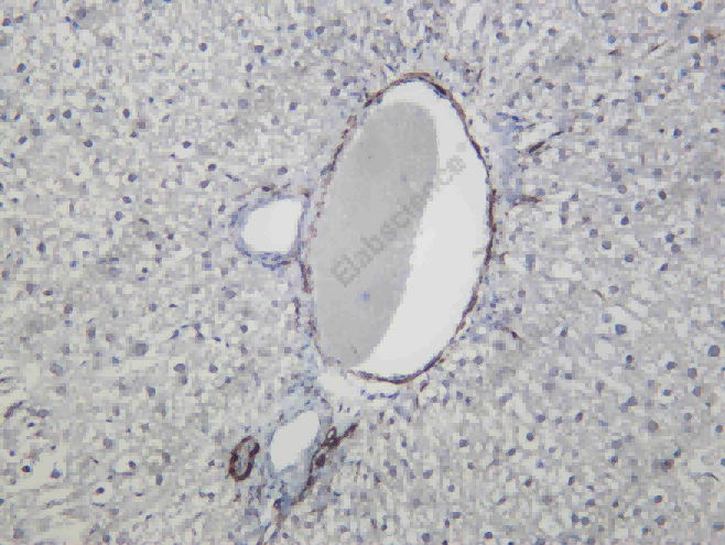 Recombinant IKKε Monoclonal Antibody - 3