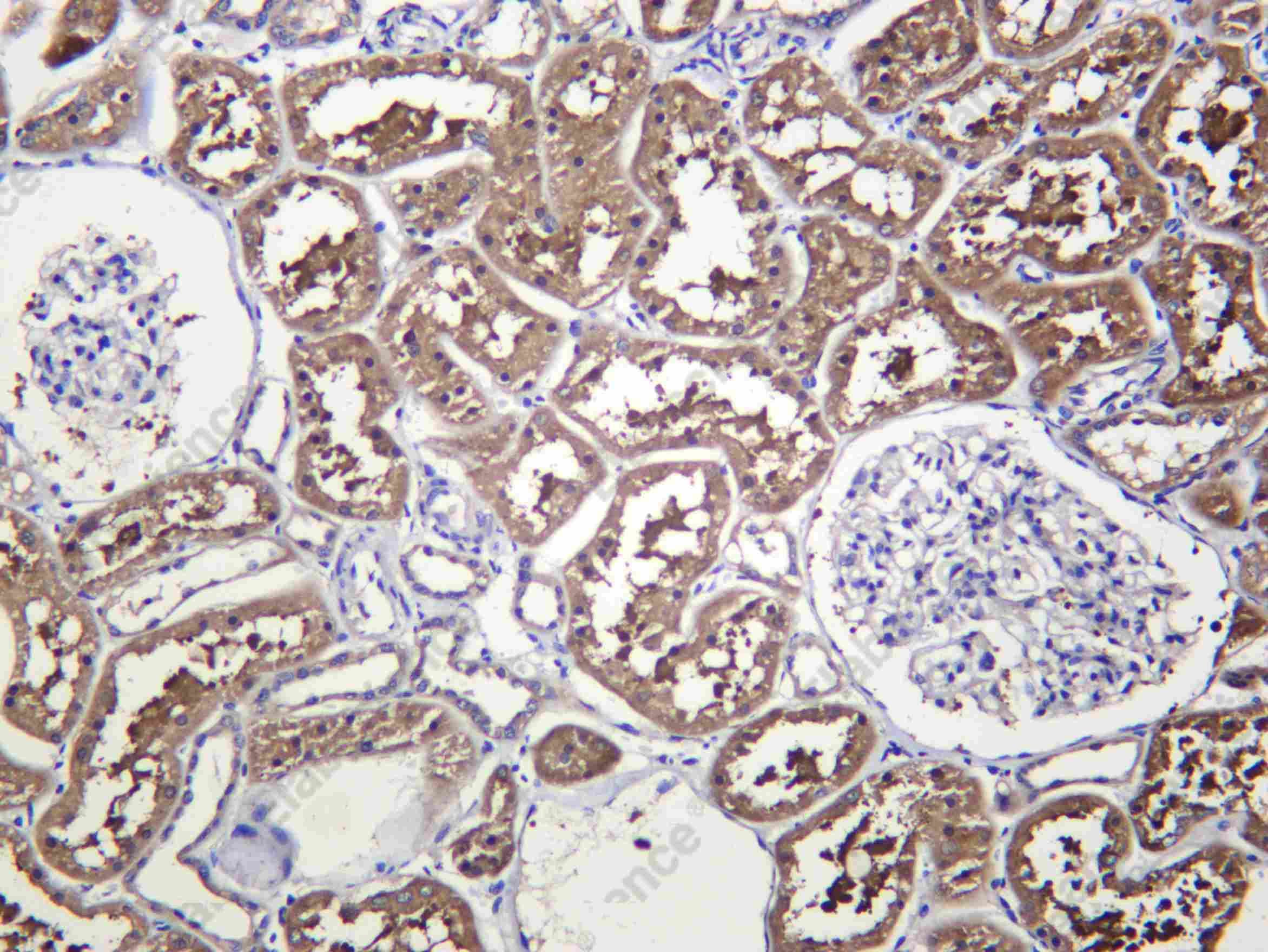 Recombinant AP2A1 Monoclonal Antibody - 1