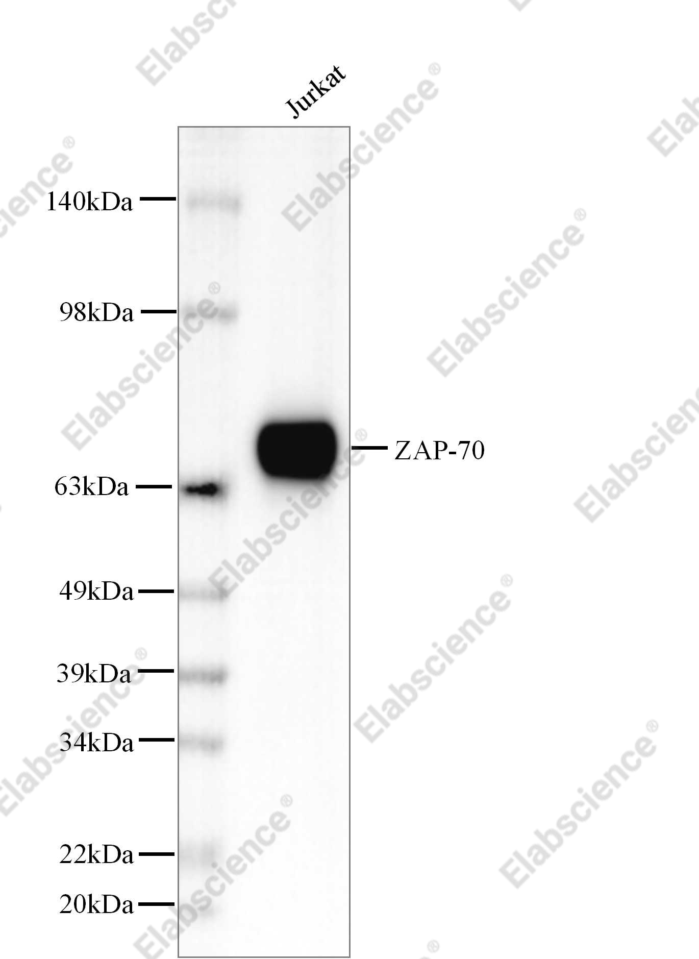 Recombinant ZAP-70 Monoclonal Antibody - 1