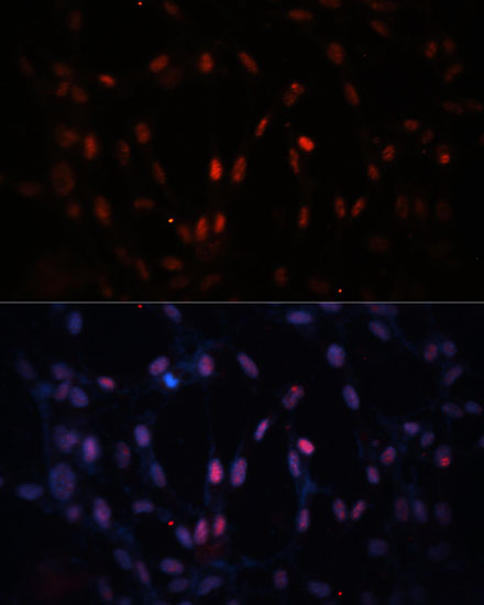 Immunofluorescence analysis of NIH-3T3 cells using KDM3A Polyclonal Antibody at dilution of 1:100 (40x lens). Blue: DAPI for nuclear staining.