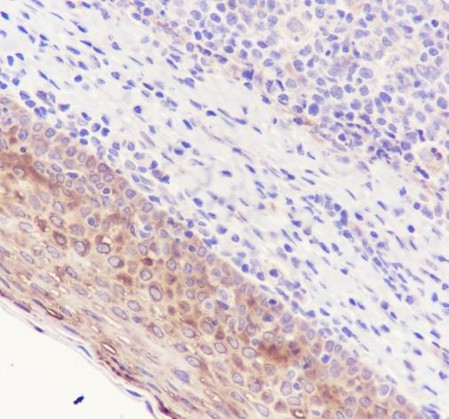 Recombinant Phospho-HSP27 (Ser78) Monoclonal Antibody - small - 4