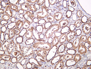 Recombinant ME3 Monoclonal Antibody - 1