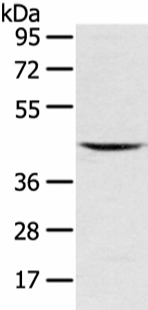 Western Blot analysis of Mouse kidney tissue using VSIG8 Polyclonal Antibody at dilution of 1/400