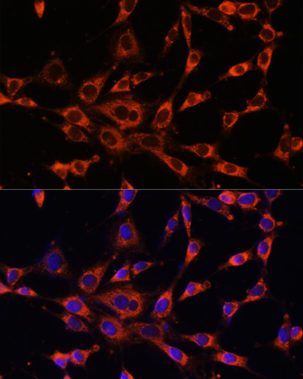 Immunofluorescence analysis of NIH-3T3 cells using ITPR3 Polyclonal Antibody at dilution of  1:100. Blue: DAPI for nuclear staining.