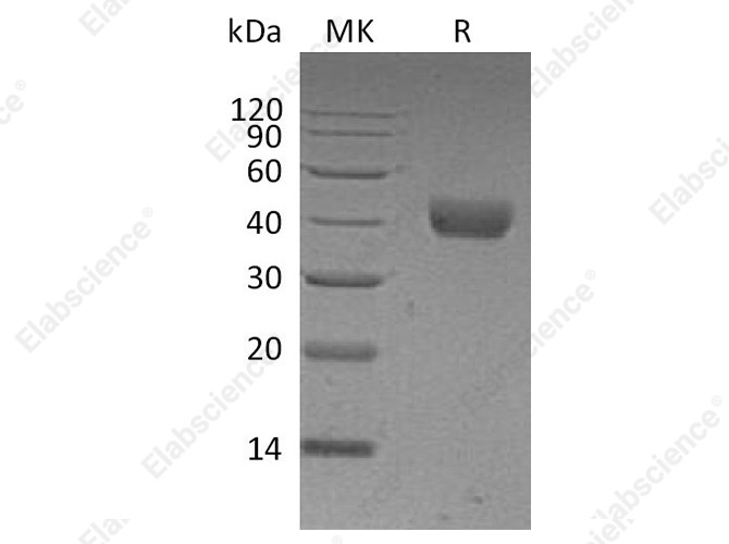 Recombinant Human CD38 Protein (His Tag) - 1