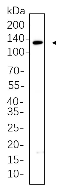Recombinant JAK1 Monoclonal Antibody-searchlist-1