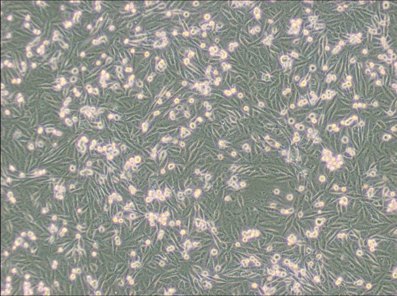 MDA-MB-231-GFP (DMEM) Cell Complete Medium - small - 6