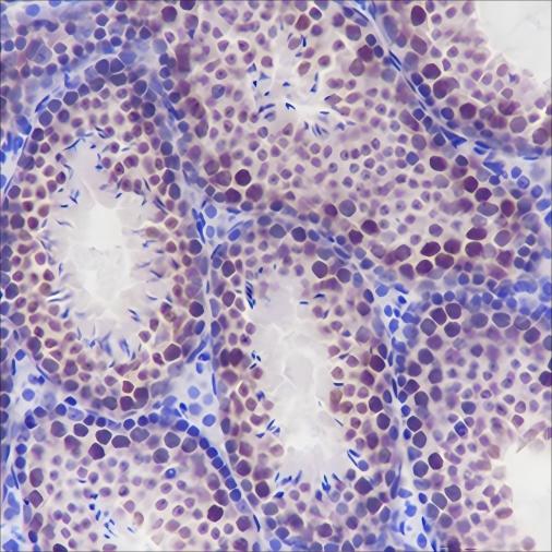 Recombinant ELP3 Monoclonal Antibody - 3