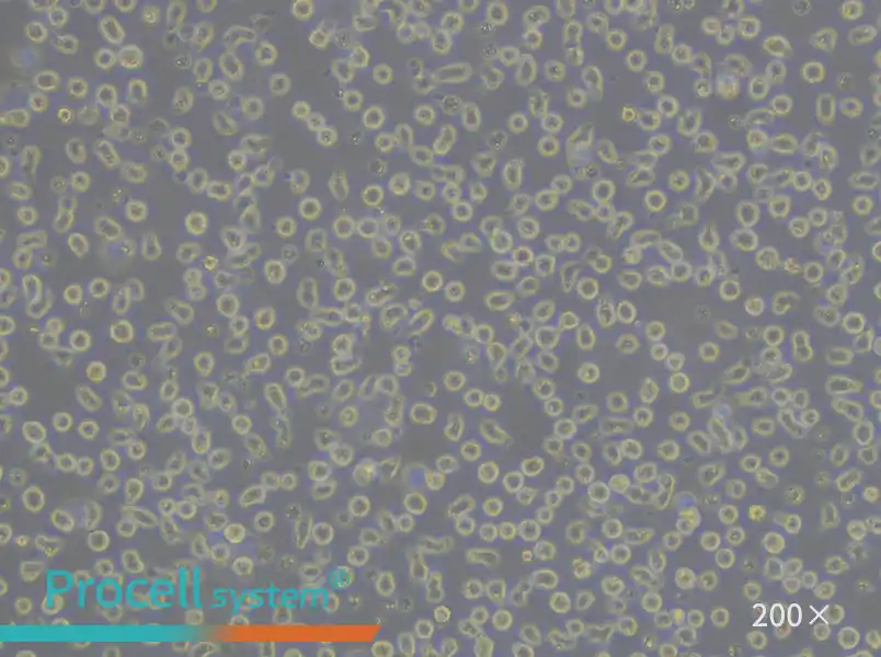 JeKo-1 Cell Complete Medium - 5