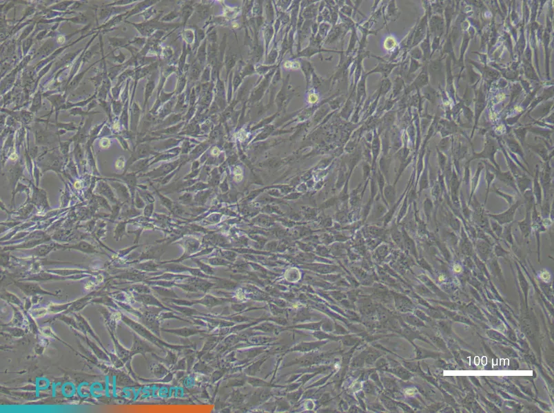 Human Bone Marrow Mesenchymal Stem (Primary cell immortalization) Cell Complete MediumHuman Bone Marrow Mesenchymal Stem (Primary cell immortalization) Cell Complete Medium - 2