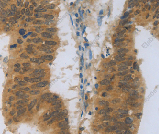 TNFRSF11B Polyclonal Antibody - 2