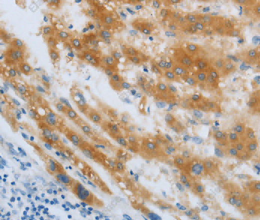 CHRNA7 Polyclonal Antibody - 2