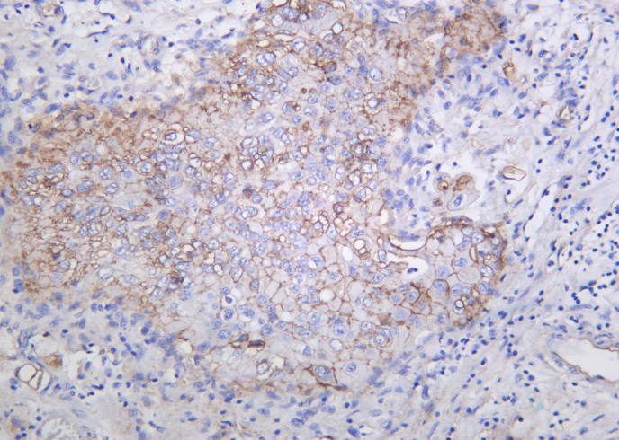 Recombinant Integrin αV Monoclonal Antibody-searchlist-1