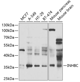 Western blot analysis of extracts of various cell lines using INHBC Polyclonal Antibody at 1:1000 dilution.