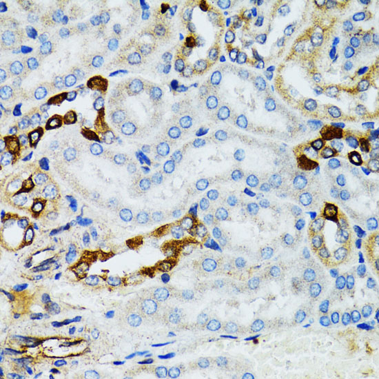 Immunohistochemistry of paraffin-embedded Mouse kidney using STAT3 Polyclonal Antibody at dilution of 1:100 (40x lens).