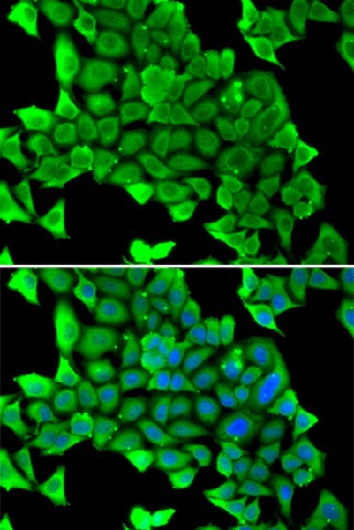 Immunofluorescence analysis of U2OS cells using MYH1 Polyclonal Antibody