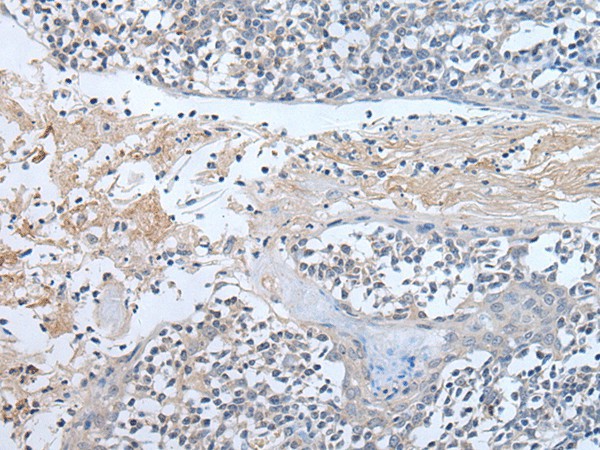 Immunohistochemistry of paraffin-embedded Human tonsil tissue  using ABR Polyclonal Antibody at dilution of 1:50(?200)