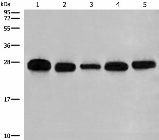 Western blot analysis of 293T A549 Hela K562 and HEPG2 cell lysates  using GATD3B Polyclonal Antibody at dilution of 1:400