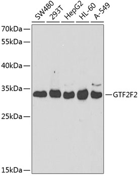 Western blot analysis of extracts of various cell lines using GTF2F2 Polyclonal Antibody at dilution of 1:1000.