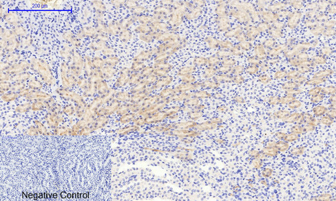 Immunohistochemistry of paraffin-embedded Mouse kidney tissue  using Phospho-IkB alpha (Ser32/S36) Polyclonal Antibody at dilution of 1:200