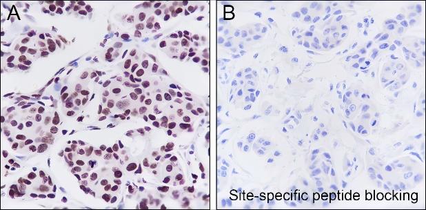 Recombinant JunB Monoclonal Antibody-searchlist-1