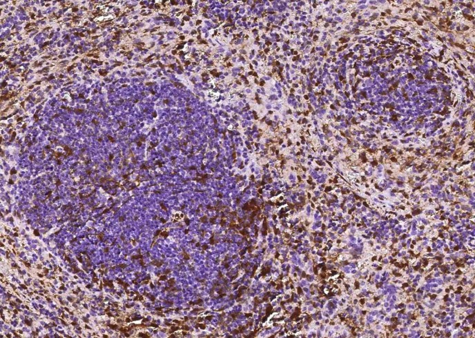 Recombinant S100A6/Calcyclin/CACY Monoclonal Antibody-searchlist-1
