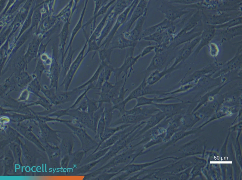 Human Pulmonary Artery Smooth Muscle (Primary cell immortalization) Cell Complete MediumHuman Pulmonary Artery Smooth Muscle (Primary cell immortalization) Cell Complete Medium - 6