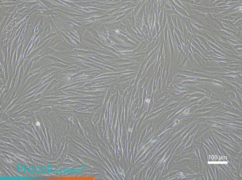 Human Vascular Adventitial Fibroblast Complete Medium - 2