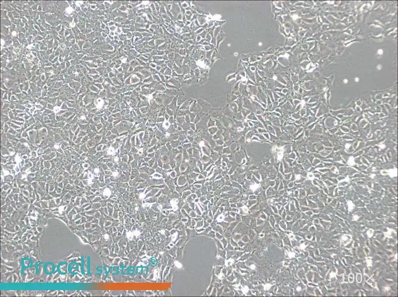 KYSE-140 Cell Complete Medium - 1