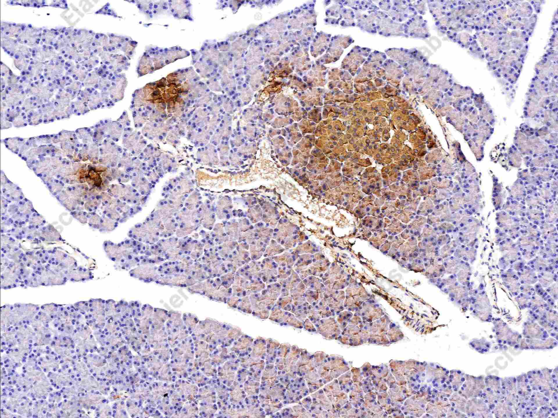 Recombinant Insulin Monoclonal Antibody - 4