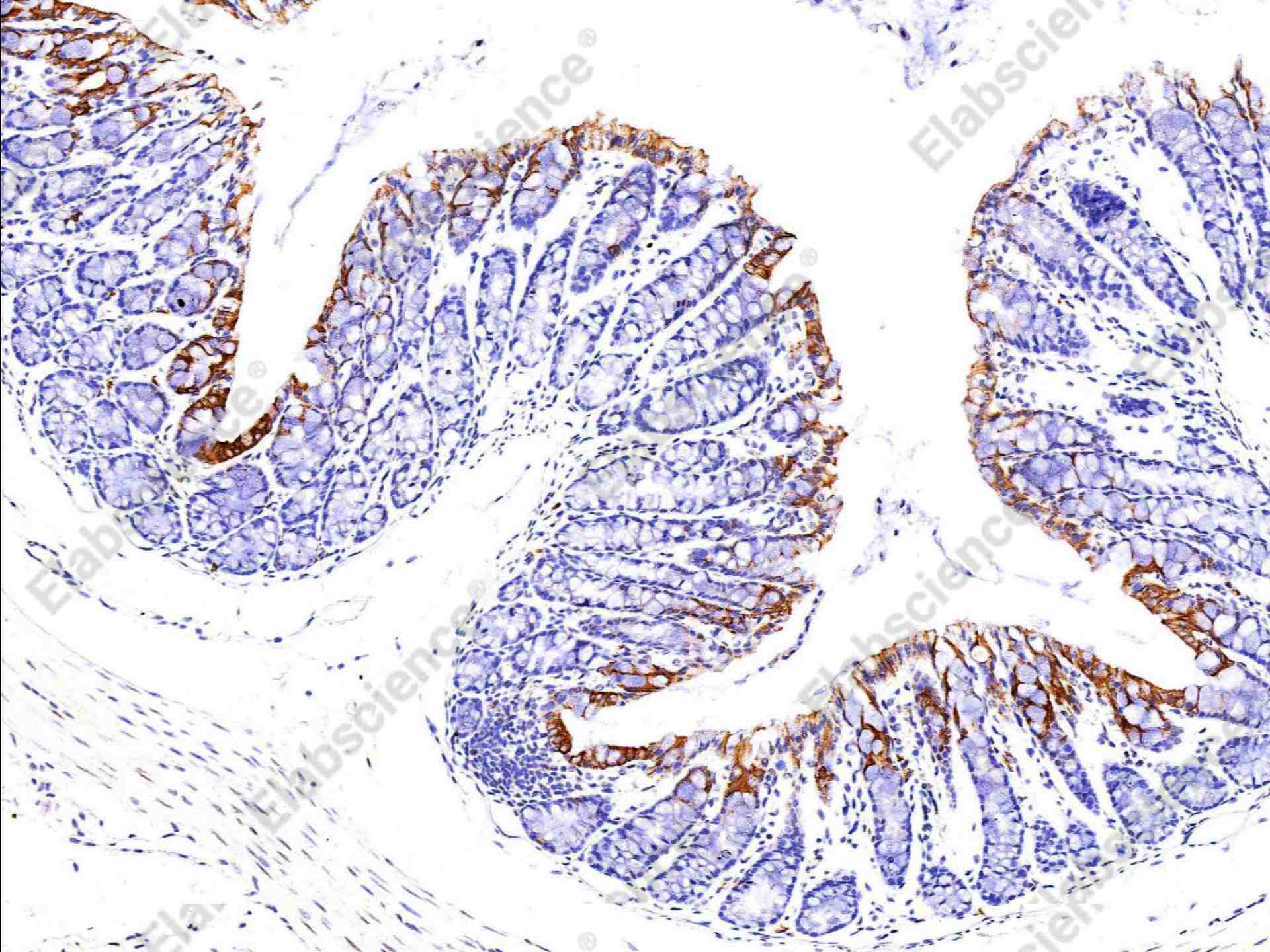 Recombinant Phospho-p90RSK (Thr359, Ser363) Monoclonal Antibody - 2