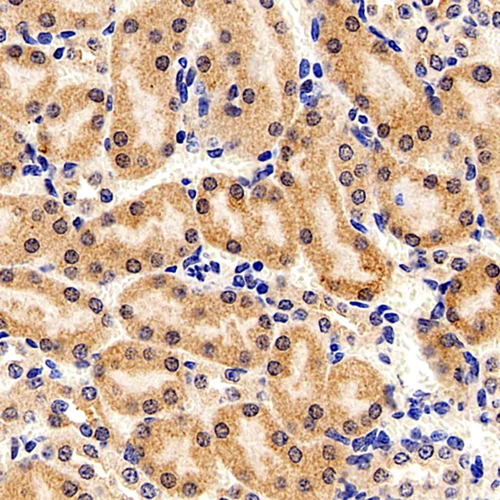 Immunohistochemistry analysis of paraffin-embedded Mouse kidney   using FOXO1 Polyclonal Antibody at dilution of 1:300.