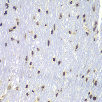 Immunohistochemistry of paraffin-embedded Mouse brain using Lyn Polyclonal Antibody at dilution of 1:100 (40x lens).