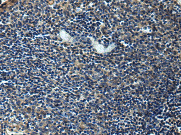 Immunohistochemistry of paraffin-embedded Human tonsil tissue  using ERLIN1 Polyclonal Antibody at dilution of 1:50(?200)