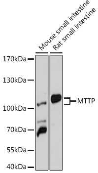 Western blot analysis of extracts of various cell lines using MTTP Polyclonal Antibody at 1:1000 dilution.