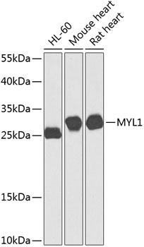 Western blot analysis of extracts of various cell lines using MYL1 Polyclonal Antibody at 1:1000 dilution.