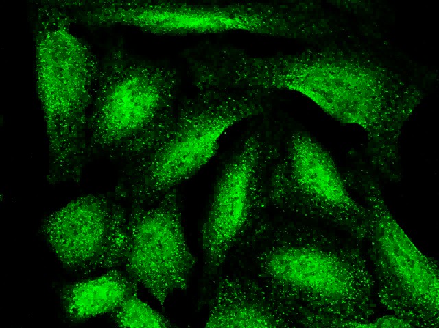 Recombinant ARL2BP/BART1 Monoclonal Antibody-searchlist-1