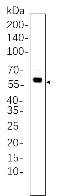 Recombinant Phospho-Akt (Thr308) Monoclonal Antibody-searchlist-1