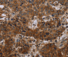 SLC1A6 Polyclonal Antibody - 2