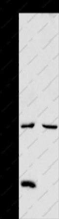 NCEH1 Polyclonal Antibody - 1
