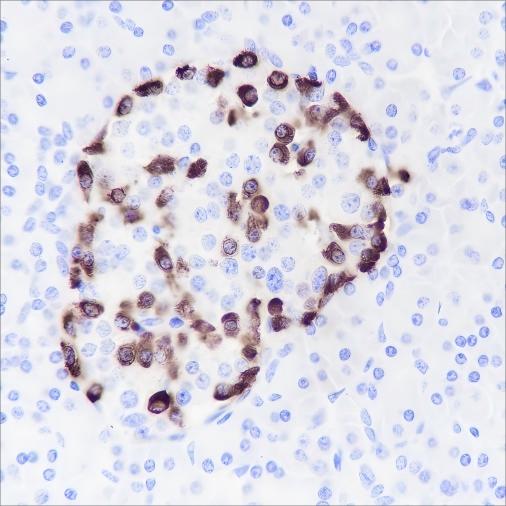 Recombinant GLP-1 Monoclonal Antibody - 2