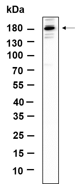 Recombinant TIAM2 Monoclonal Antibody-searchlist-1