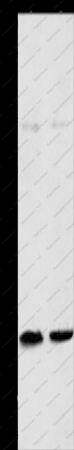 MYL9 Polyclonal Antibody - 1
