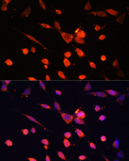 Immunofluorescence analysis of NIH-3T3 cells using PIK3R3 Polyclonal Antibody at dilution of  1:100. Blue: DAPI for nuclear staining.