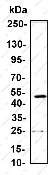 Recombinant TRIB3 Monoclonal Antibody - 1