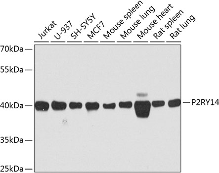 Western blot analysis of extracts of various cell lines using P2RY14 Polyclonal Antibody at dilution of 1:1000.