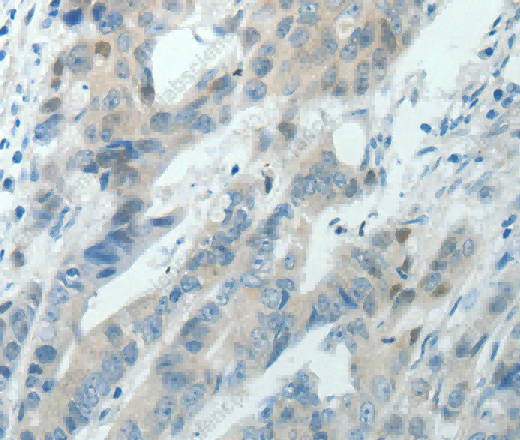 RNF126 Polyclonal Antibody - 2