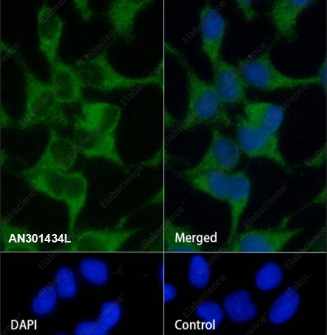 Recombinant Alpha B Crystallin Monoclonal Antibody - 1