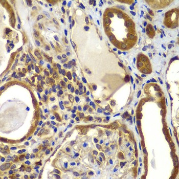 Immunohistochemistry of paraffin-embedded human kidney using NME2/NM23B Polyclonal Antibody at dilution of 1:100 (40x lens).Perform microwave antigen retrieval with 10 mM PBS buffer pH 7.2 before commencing with IHC staining protocol.
