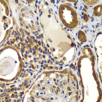 Immunohistochemistry of paraffin-embedded human kidney using NME2/NM23B Polyclonal Antibody at dilution of 1:100 (40x lens).Perform microwave antigen retrieval with 10 mM PBS buffer pH 7.2 before commencing with IHC staining protocol.